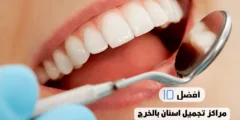 أفضل 10 مراكز تجميل اسنان بالخرج