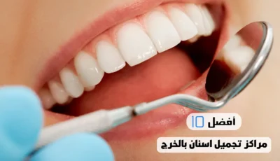 أفضل 10 مراكز تجميل اسنان بالخرج