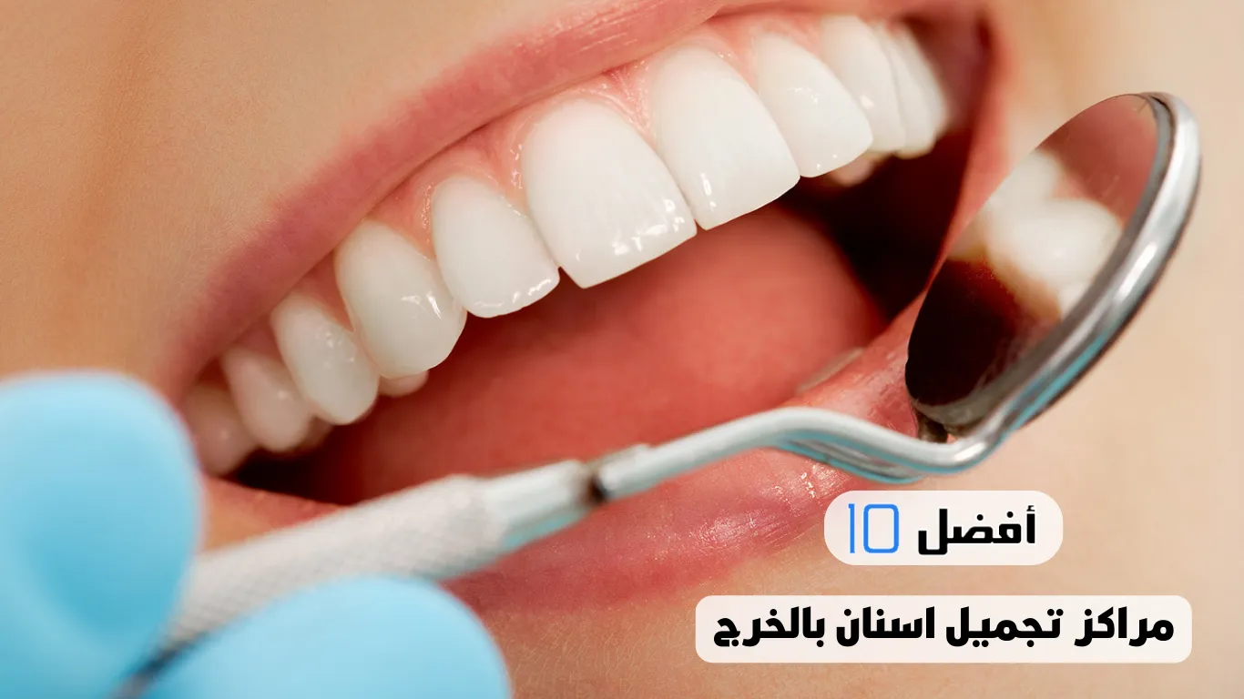 أفضل 10 مراكز تجميل اسنان بالخرج