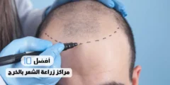 أفضل 10 مراكز زراعة الشعر بالخرج