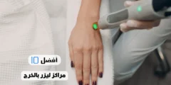 أفضل 10 مراكز ليزر بالخرج