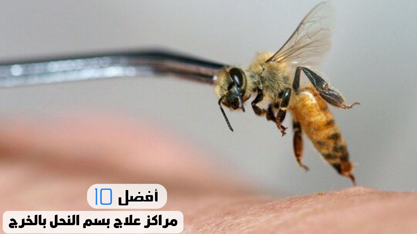 أفضل 10 مراكز علاج بسم النحل بالخرج