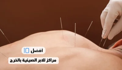 أفضل 10 مراكز للابر الصينية بالخرج