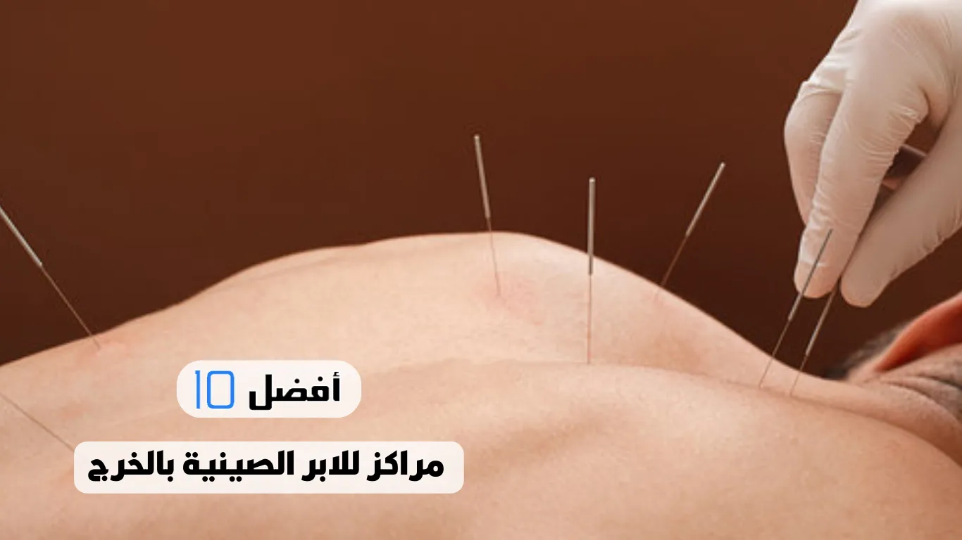 أفضل 10 مراكز للابر الصينية بالخرج