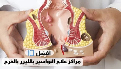 أفضل 10 مراكز علاج البواسير بالليزر بالخرج