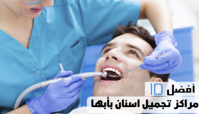 أفضل 10 مراكز تجميل اسنان بأبها